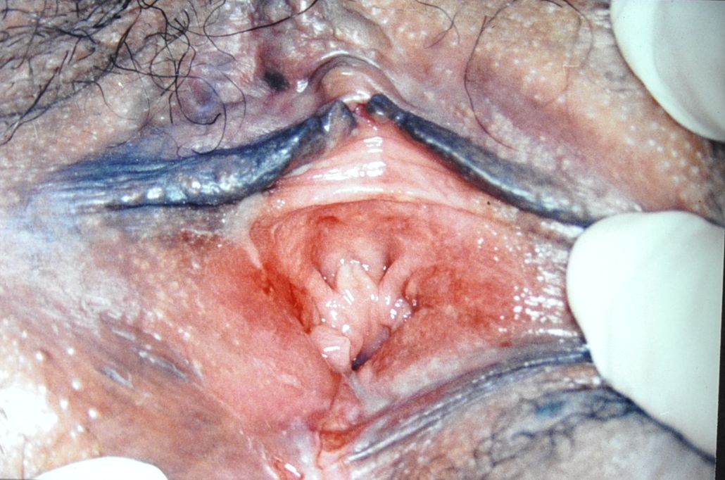 Penis tears vagina Black clip free slut